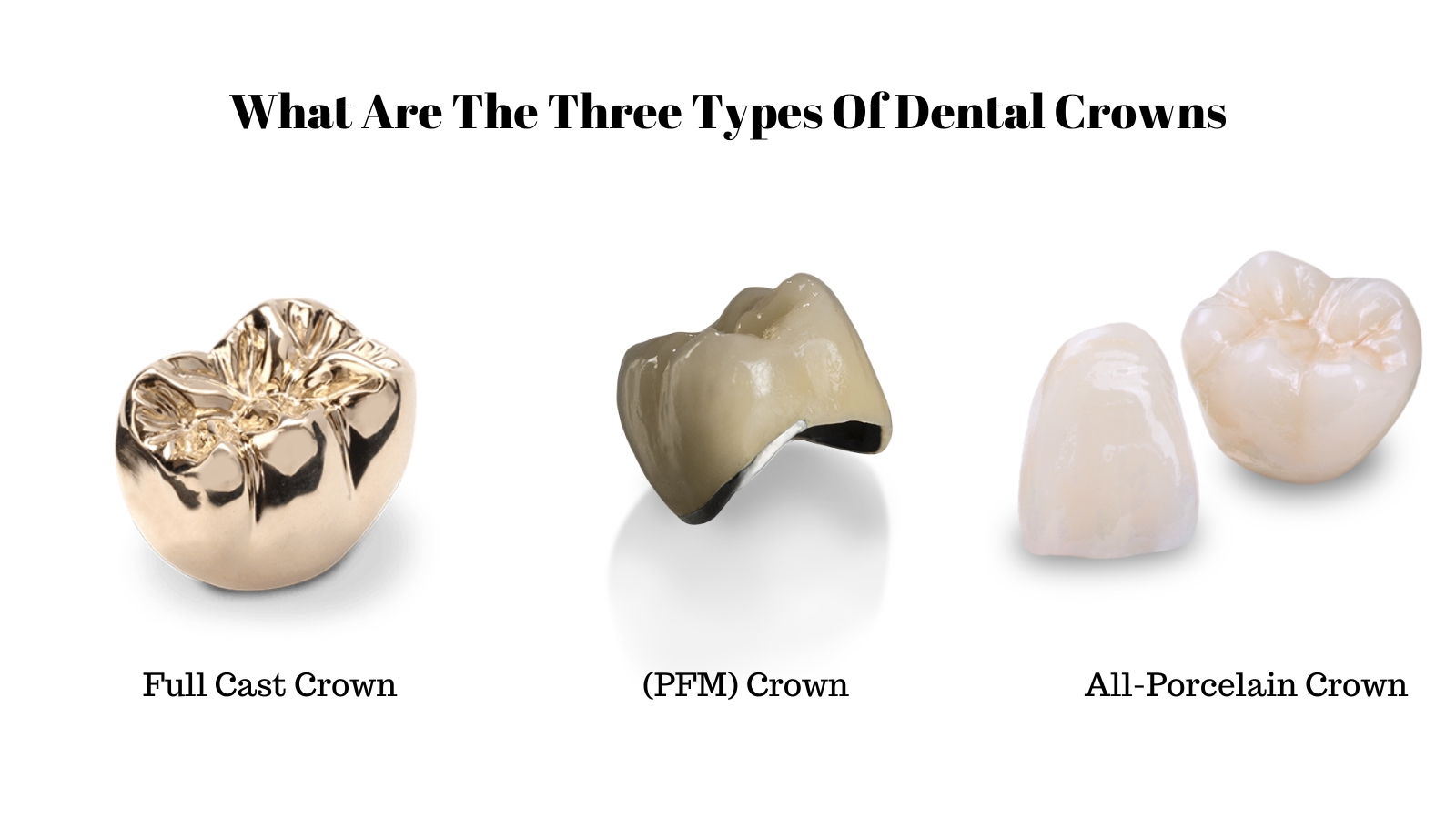 What are the three types of dental crowns