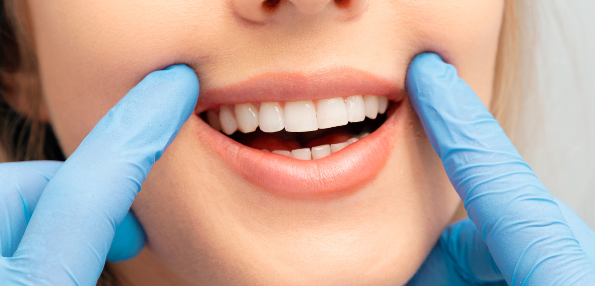 Why Regular Dental Cleanings Are Essential for a Healthy Smile