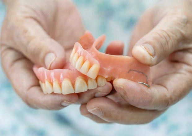 What Are Snap-In Implant Dentures