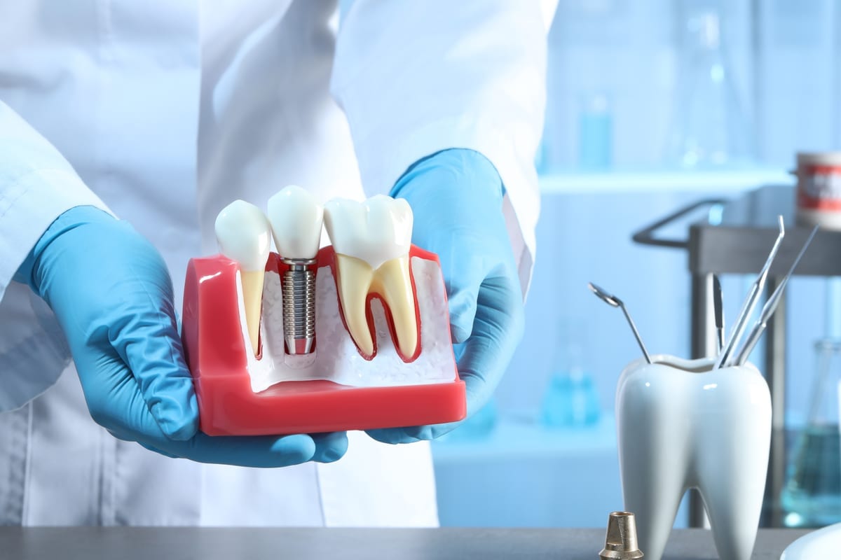 Dental Implants in Mid-Cambridge