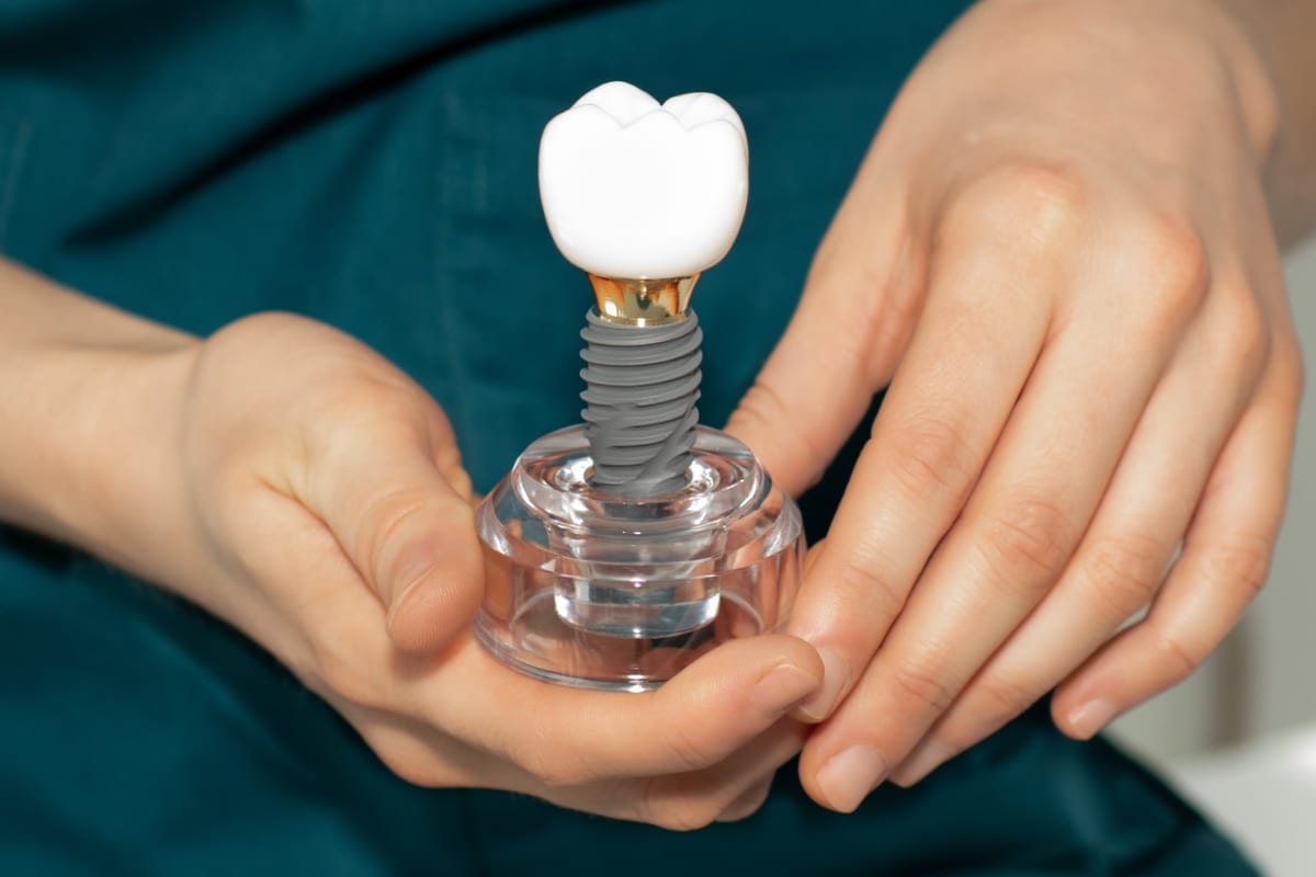 Dental Implants in Cambridge